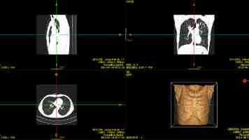 手撸二叉搜索树：从底层原理到代码实现，深度剖析与避坑指南