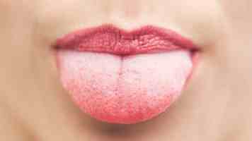 博客系统性能瓶颈排查与优化实战：从压测到代码级调优